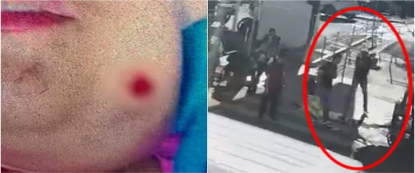 Jovem autista é baleada no rosto após sorrir para homem em Goiânia/GO