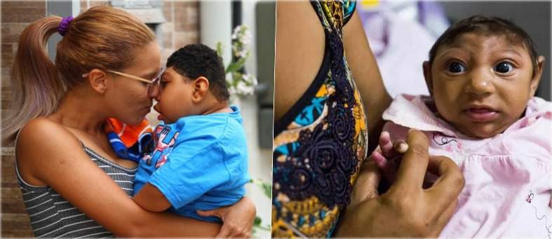 Governo regulamenta pensão vitalícia às crianças com zika vírus